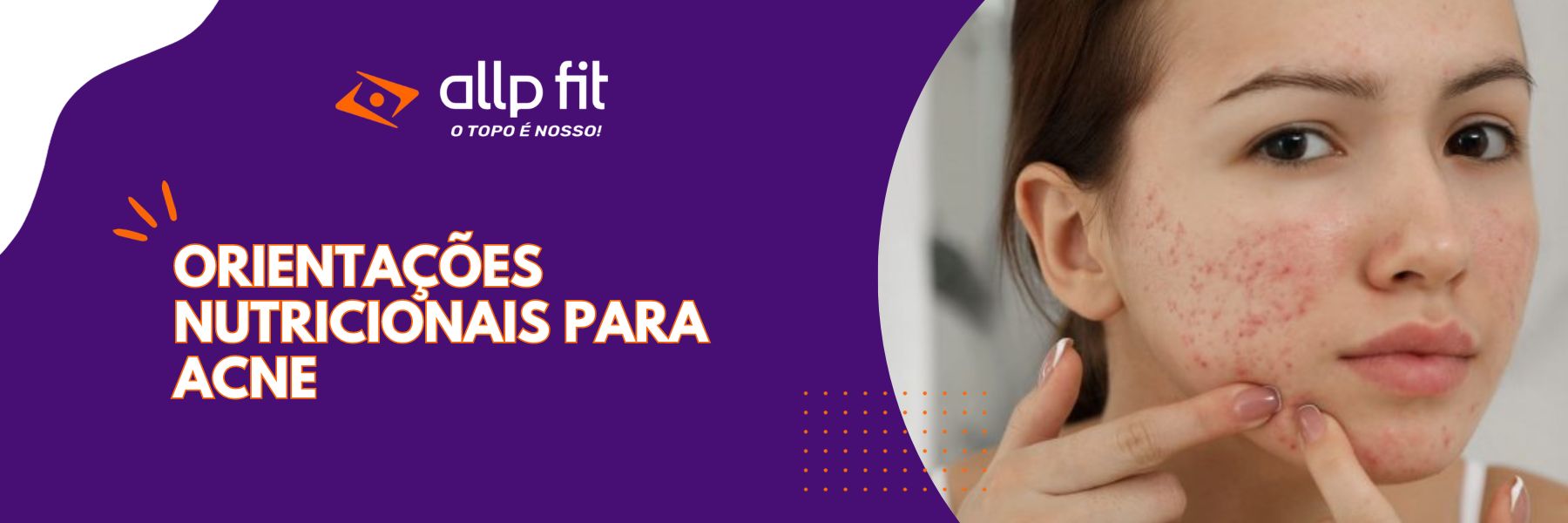 Orientações Nutricionais para Acne