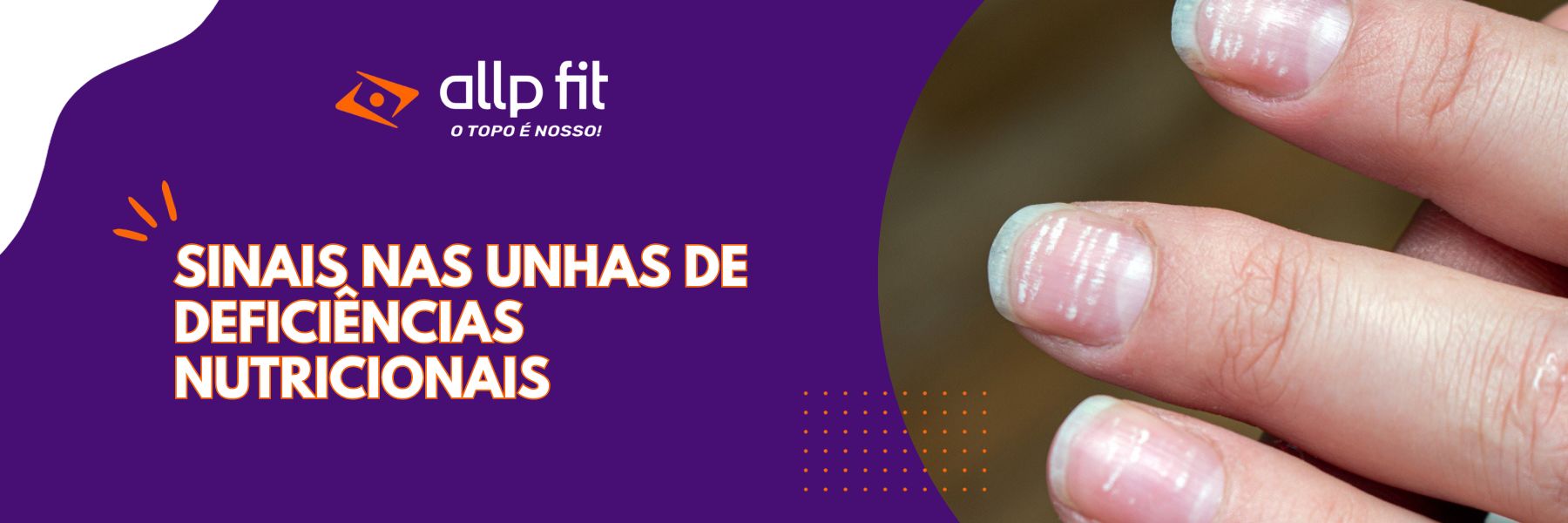 Sinais nas unhas de Deficiências Nutricionais